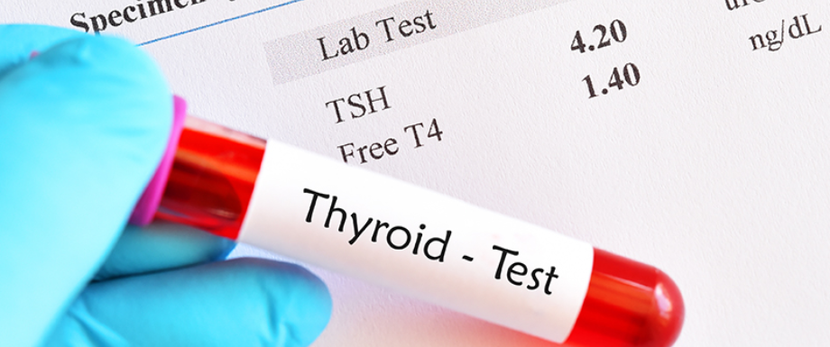 	
Thyroid Function Tests & Hypothyroidism